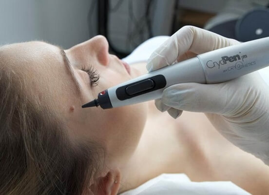 cryopen
